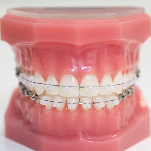 nimble_asset_contact_two_bw