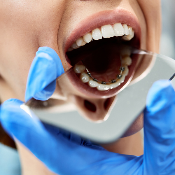 nimble_asset_contact_two_bw