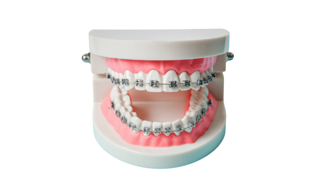 Cuidado de los brackets