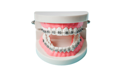 Cuidado de los brackets