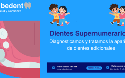 Que son los dientes Supernumerarios