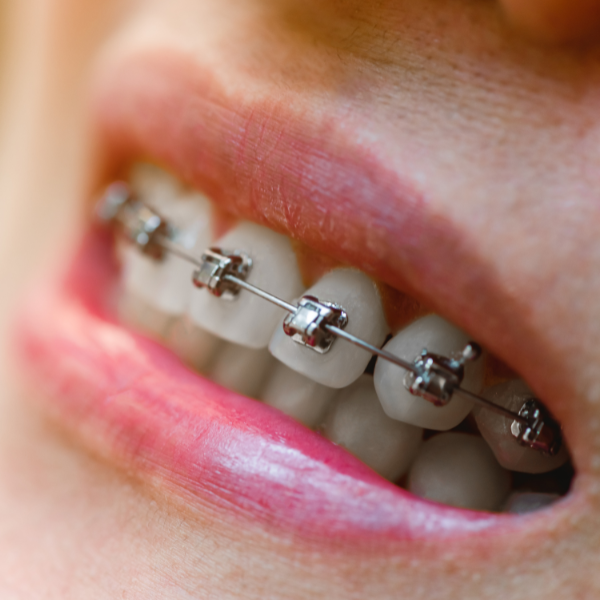 nimble_asset_contact_two_bw